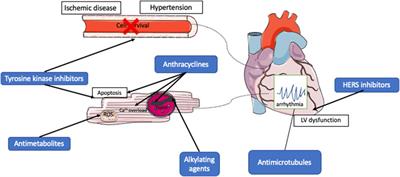 Human Pluripotent Stem Cells for Modeling of Anticancer Therapy-Induced Cardiotoxicity and Cardioprotective Drug Discovery